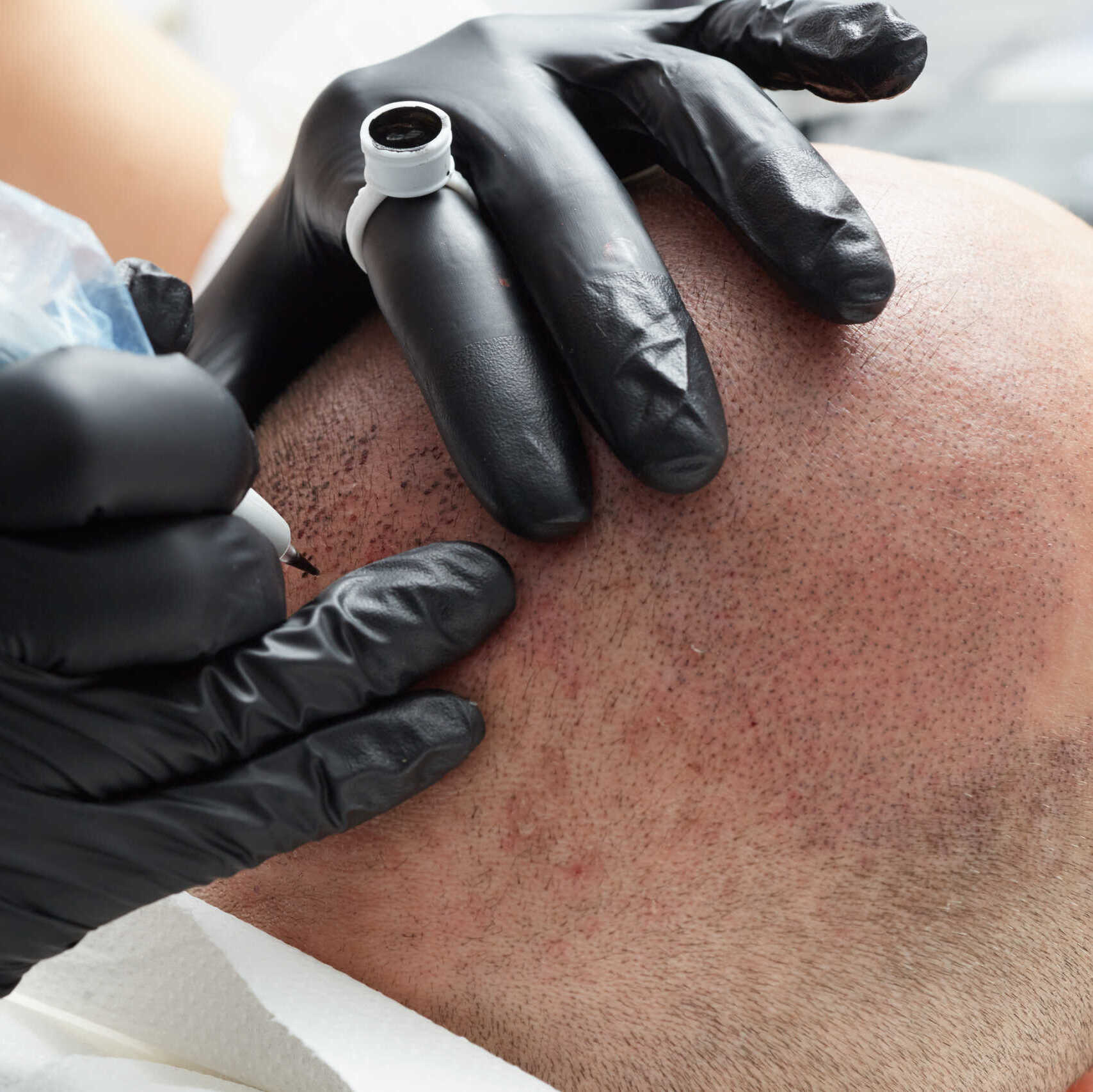 Cosmetologist making permanent makeup on man head - tricopigmentation Dermopigmentare Capilar