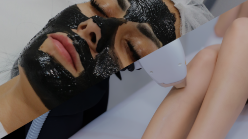 3 ȘEDINȚE EPILARE DEFINITIVĂ PICIOARE + TRATAMENT LASER CARBON